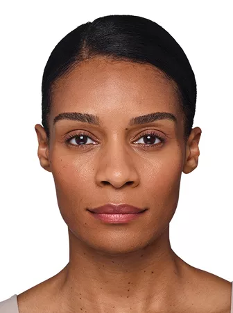 Headshot Kristin- Juvederm Customise After 2