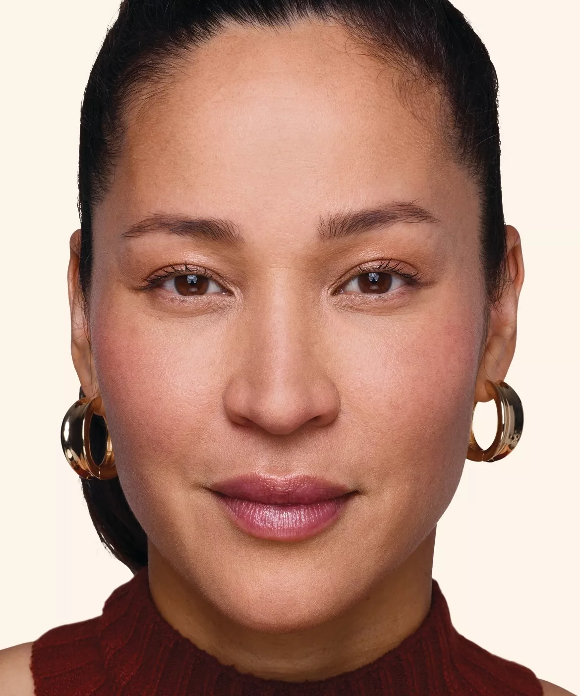 Juvederm Treatment Points