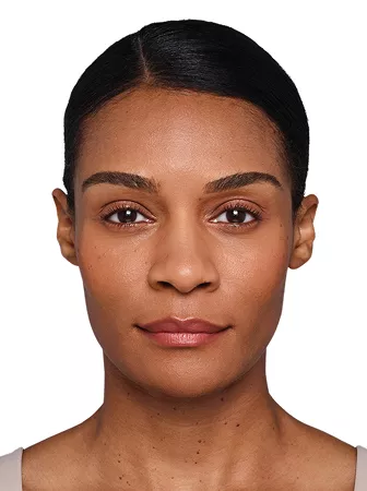 Headshot Kristin- Juvederm Before