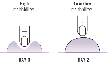 Graphic comparing the moldability of JUVEDERM® VOLUMA® XC over 2 days.