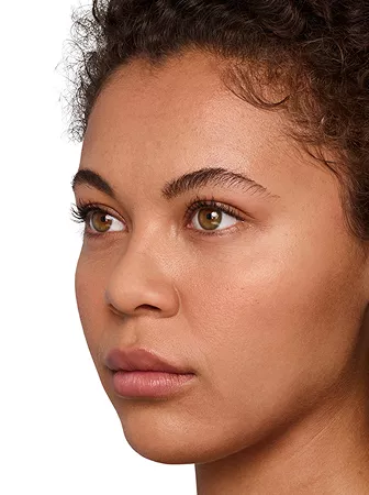 Headshot Jazz - Juvederm Optimise After 2