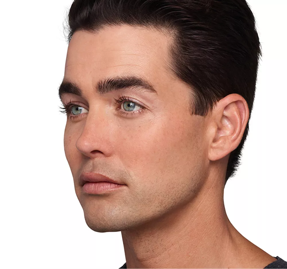 Headshot Sterling- Juvederm Optimise After 1