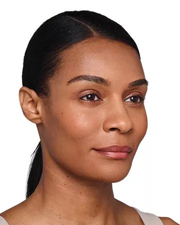 Headshot Kristin- Juvederm Optimise After 3