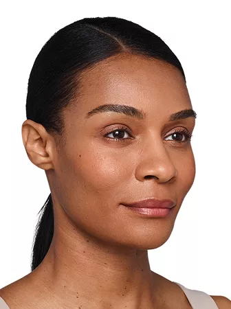 Headshot Kristin- Juvederm After 1