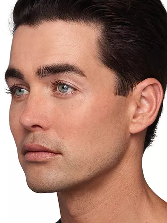 Headshot Sterling- Juvederm Optimise After 1