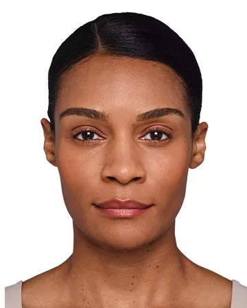 Headshot Kristin- Juvederm Customise After 2