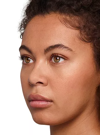 Headshot Jazz - Juvederm Optimise After 1