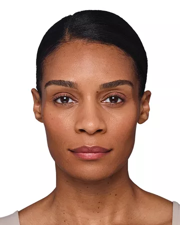 Headshot Kristin- Juvederm Before