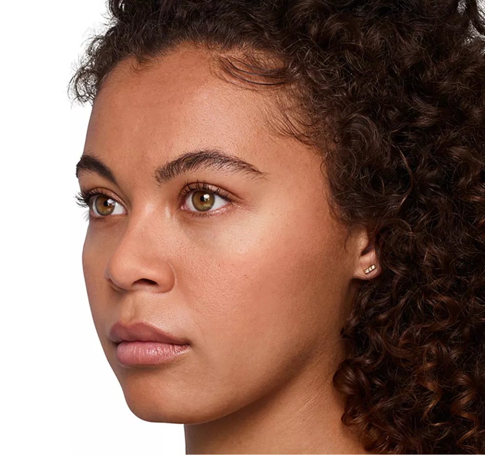 Headshot Jazz - Juvederm Before