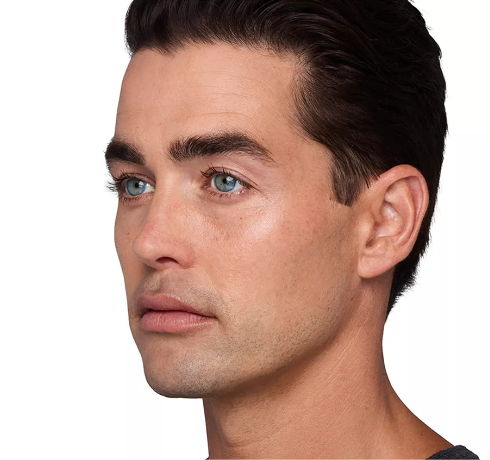 Headshot Sterling- Juvederm Before