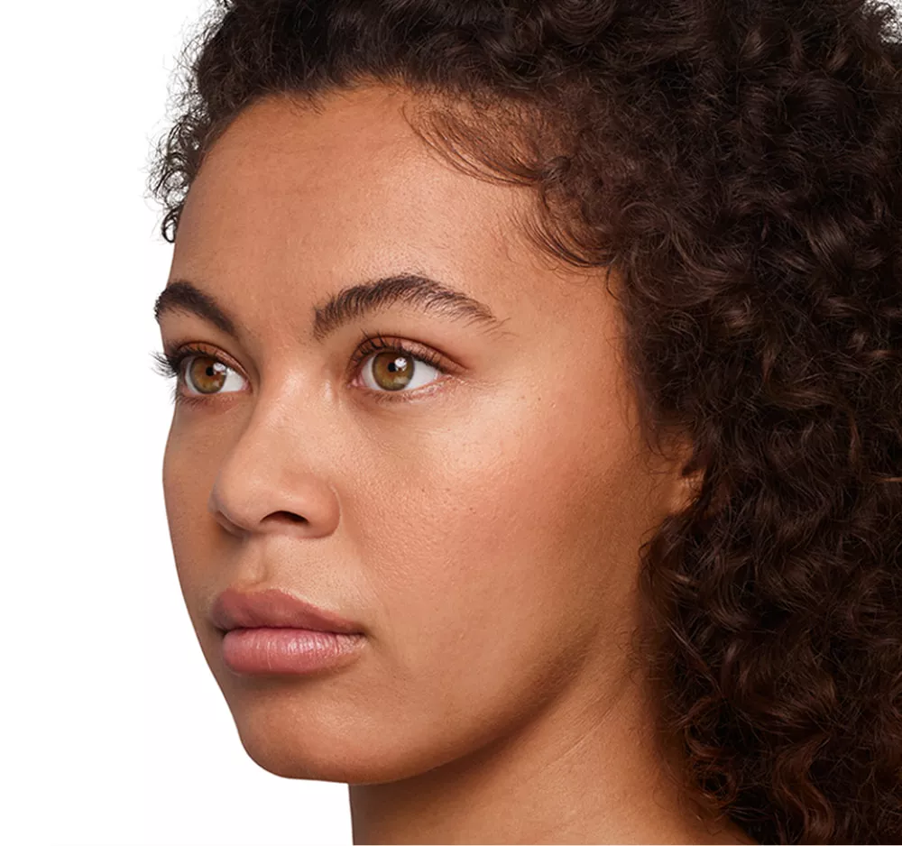 Headshot Jazz - Juvederm Optimise After 1