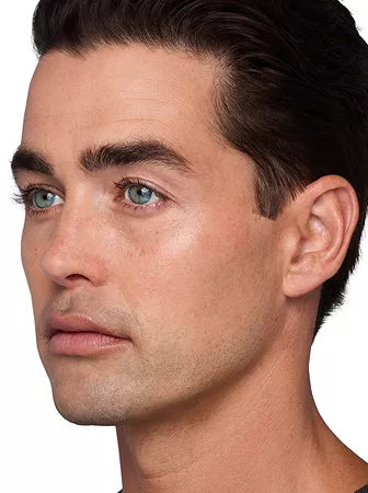 Headshot Sterling- Juvederm Before