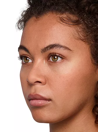 Headshot Jazz - Juvederm Before