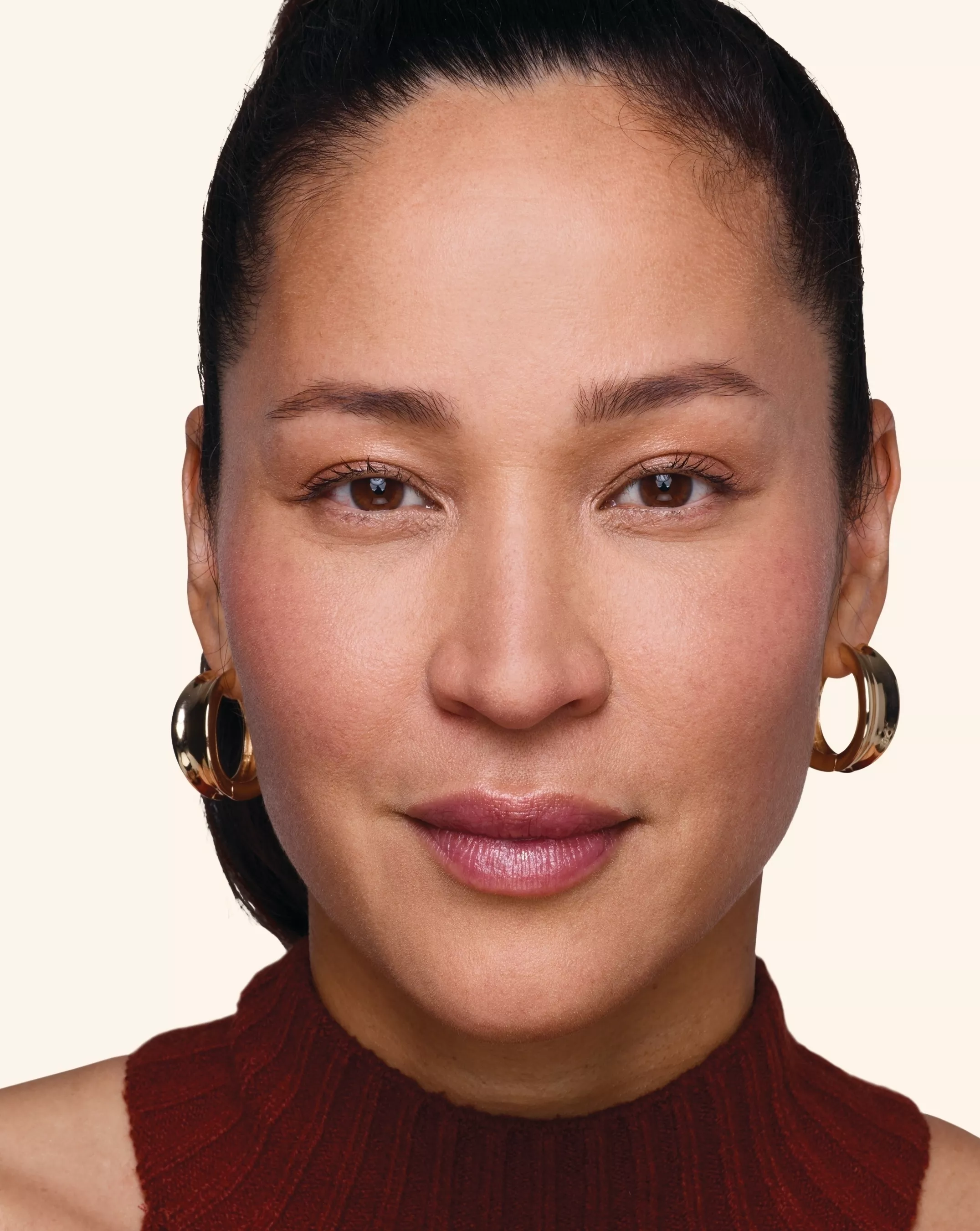 Juvederm Treatment Points